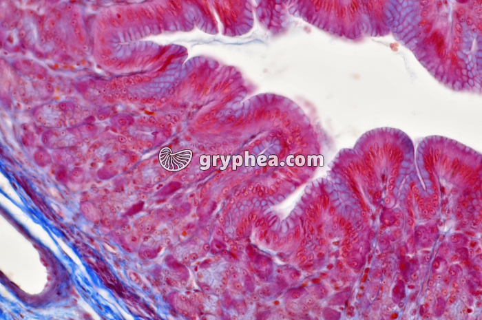 Estomac pylorique x100 - gryphea.org